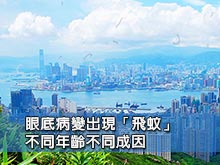眼底病變出現「飛蚊」 不同年齡不同成因