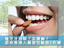 植牙牙冠裂了怎麼辦？原來香港人最常忽略這6件事