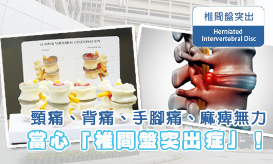 頸痛、背痛、手腳痛、麻痺無力
當心「椎間盤突出症」