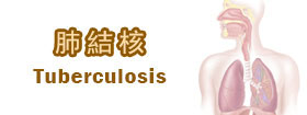 肺結核 - Tuberculosis