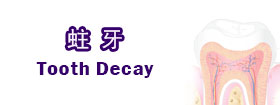 蛀牙[Tooth Decay]