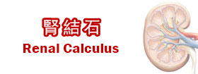 腎結石 - Renal Calculus