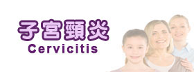 子宮頸炎Cervicitis