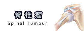 脊椎瘤Spinal Tumour