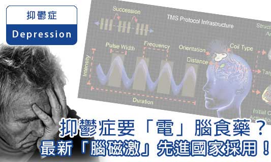 抑鬱症要「電」腦食藥？
最新「腦磁激」先進國家採用！